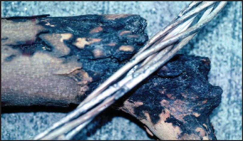 Tree limb in contact with high-voltage utility conductor line. (click in image to see full-size image)